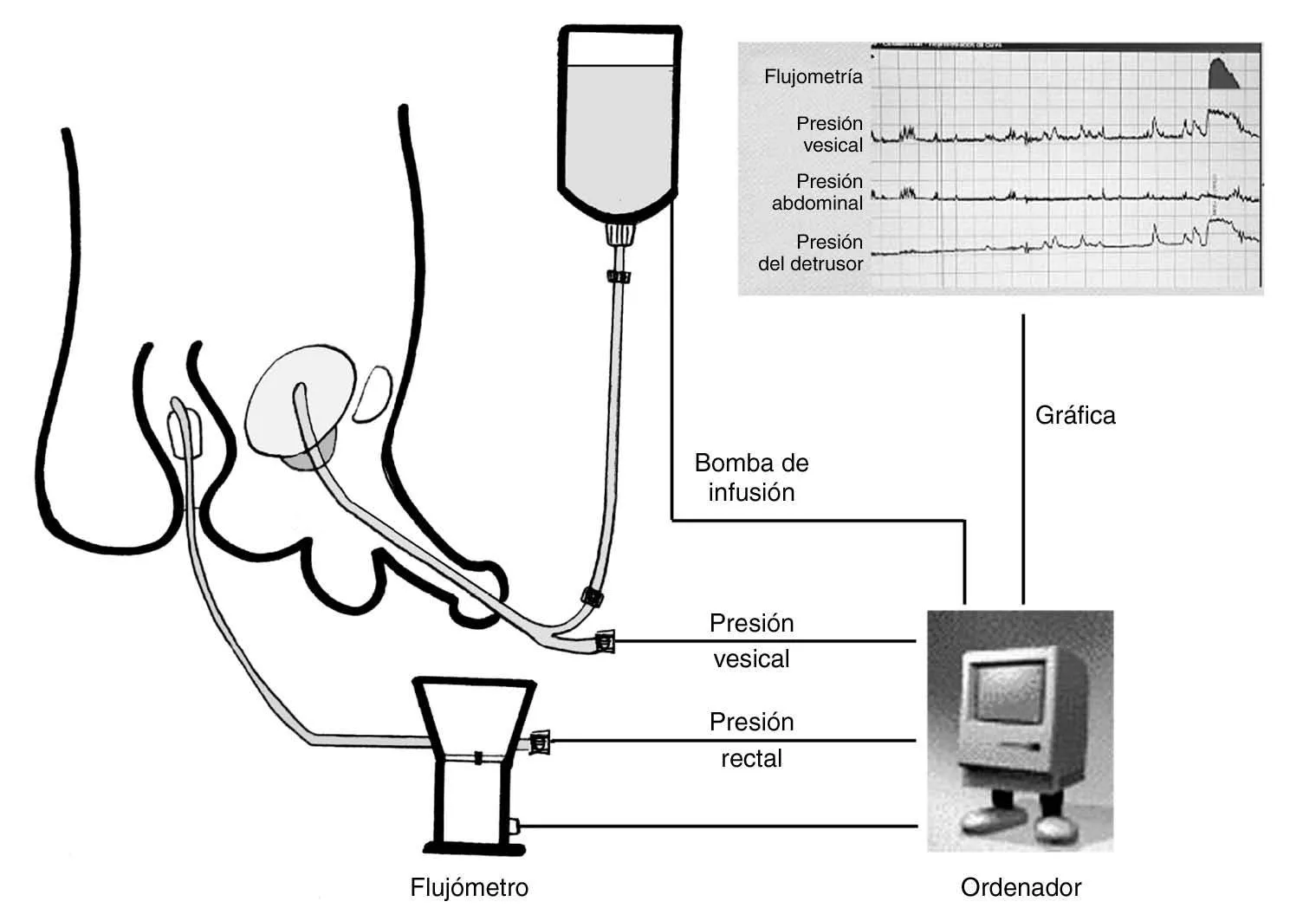 Estudio presión-flujo
