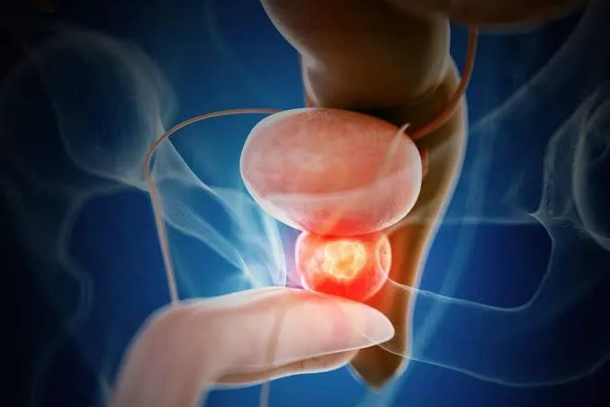 Consulta de oncología urológica con el Dr. Sandoval Valle en Hermosillo