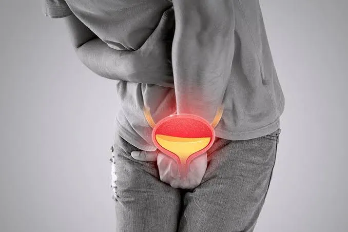 Urgencia urinaria por vejiga hiperactiva: síntomas y causas